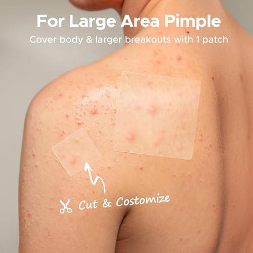 TKTK Large Pimple Patches, 60 mm XL Acne Patches, Big Hydrocolloid Bandages for Body, Face, Forehead, Chin, Neck Zit Breakouts, Hydrocolloid Patch (Square, Strip, Dot 5 Sizes 62 Count) (Pack of 2)