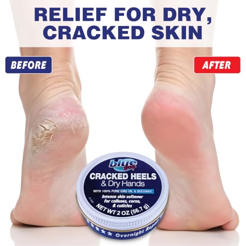 Blue Goo Cracked Heels & Dry Hands Skin Protectant 2 oz - Pack of 3
