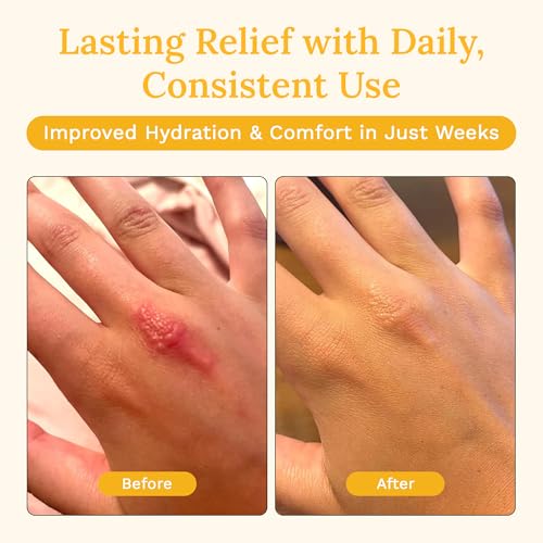 Rejuvaskin Skin Recovery Cream 3.38 Fl Oz Hydrates Dry & Sensitive Skin