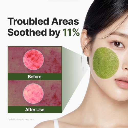 P.CALM Azelaic Acid Matcha Gauze Gel Toner Pads, 60 Individually Soaked Exfoliating Masks