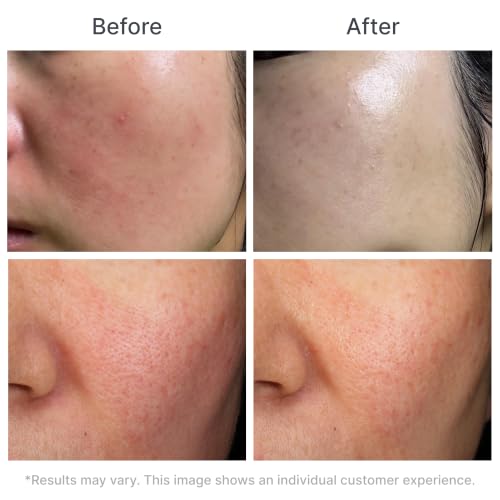 Hydrogel Face Mask for Sensitive Skin - Deep Hydration & Calm - 5 Sheets
