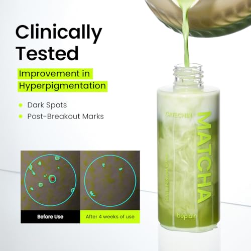 Beplain Matcha Catechin Essence 5% Niacinamide – 5.07 fl oz (Variation: Matcha Essence)