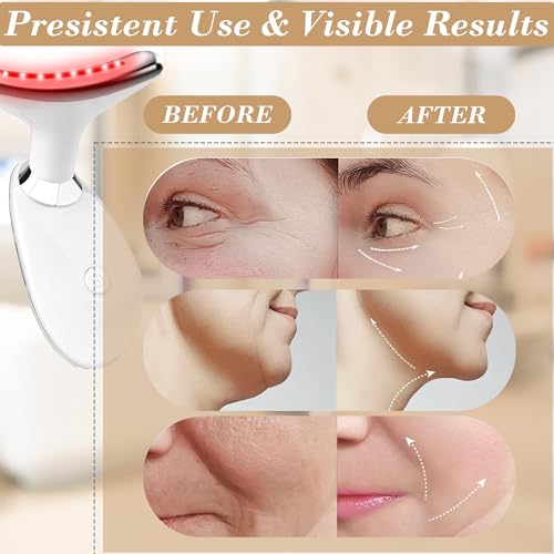 Facial Massager for Women and Men White - Skin Tightening & Wrinkle Reduction