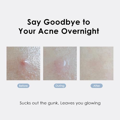 ASAP Active Spot Patches 8/10/12mm – 52 Hydrocolloid Acne Patches Pack of 2 ( variation: 133 x 80 x 18 mm )