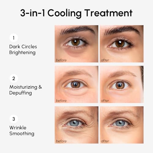 Eye Gels & Facial Masks Bundle - Under Eye Puffiness Dark Circles Hydrating