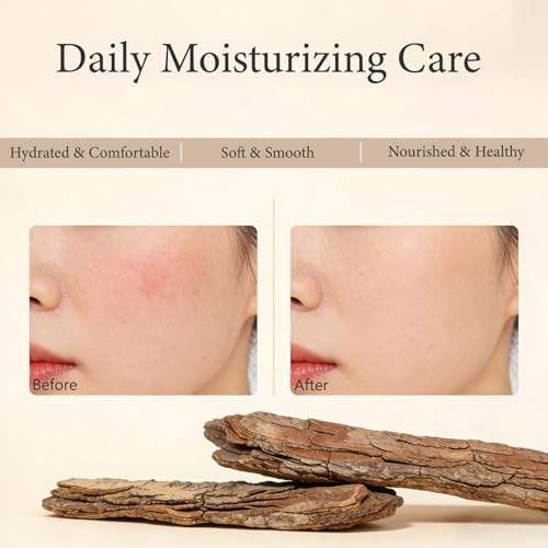 PDRN Cream, Face Moisturizer with PDRN & Niacinamide, Soothing & Hydrating Gel Formula, Lightweight Gel Cream for Face, 0.68 Fl Oz (1)