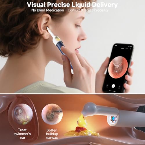 BEBIRD R1 Ultra Ear Wax Removal Kit with 1296P HD Ear Camera – Blue