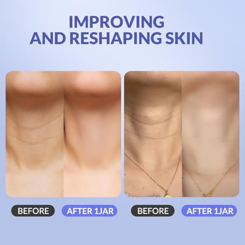 Crogooe Neck Firming Cream - Neck Creams for Tightening and Firming, Tightening and Lifting Wrinkles & Crepey Skin for Neck & D?collet?-1.7 fl.oz