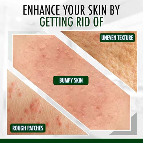 GLY MIRACLE Fragrance-Free Non-Greasy Body Lotion, 16 oz High-Glycerin Moisturizer for Sensitive, Extremely Dry Skin, Hands, Feet & Body