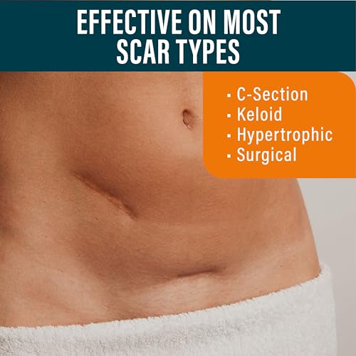 NUVADERMIS Silicone Scar Sheets - Extra Long Scar Sheets 2 Packs of 4 - Medium Tone for C-Section Tummy Tuck Keloid Surgical Scars