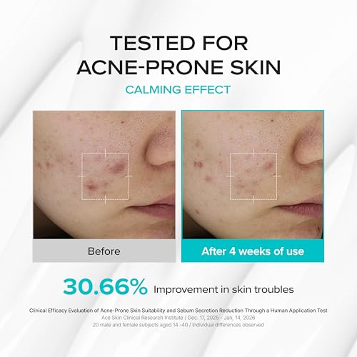 Azelaic Balancing Moisturizer for Sensitive Skin - Lightweight Korean Skincare 100ml