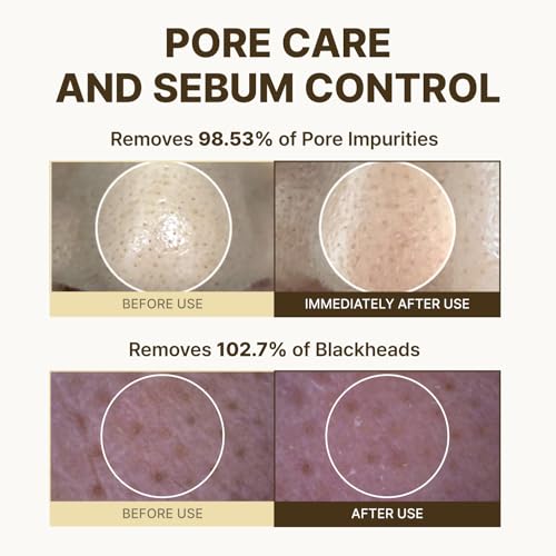 Rbfy One Step Cleansing Oil for Makeup, Sebum & Blackhead Removal - Gentle Deep Pore Cleanser