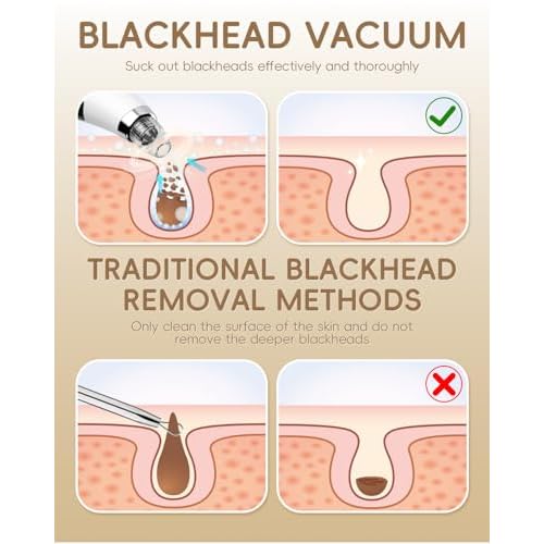 Rechargeable Blackhead Vacuum Pore Cleaner - 5 Attachments & 3 Suction Levels for Deep Facial Cleansing, USB-Powered Blackhead Remover for Women and Men (White)