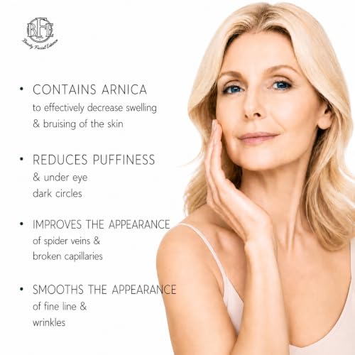 Vitamin K Cream with Arnica for Bruising Dark Circles & Spider Veins – Moisturizing Face & Body Care