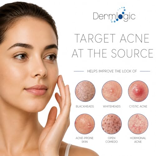 Dermlogic Acne Spot Treatment - Fast-Acting Clear Skin Formula for Face & Body