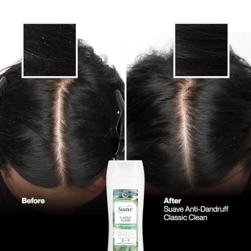 Anti-Dandruff 2-in-1 Shampoo & Conditioner for Flake-Free Hair - 6 Count