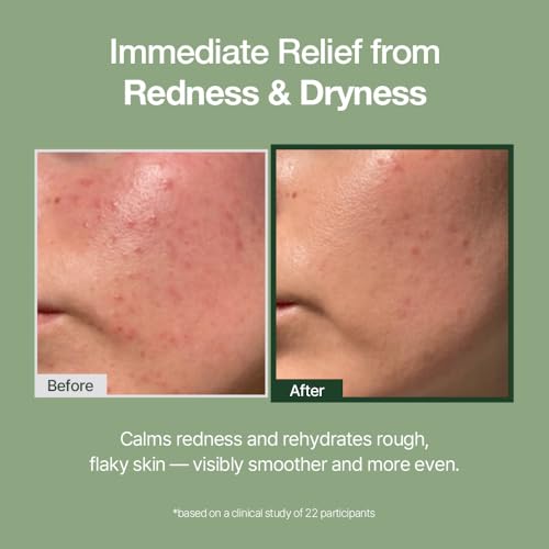 Deep Hydration Face Moisturizer for Sensitive Skin - 80ml Natural Derma Project