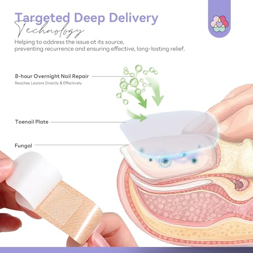 Fungal Nail Patches with 1% Tolnaftate - Overnight Nail Repair (64 Pieces)