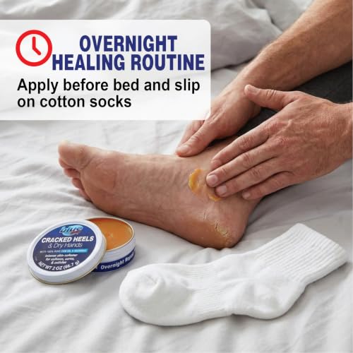 Blue Goo Cracked Heels & Dry Hands Skin Protectant 2 oz - Pack of 3
