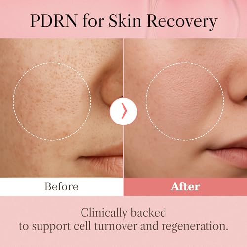 Red PDRN Oil Capsule Serum, Lightweight Hydrating Daily Serum, Hyaluronic Acid & Niacinamide, Plumping, Skin Firming, Vegan PDRN, Makeup Prep, Korean Skin Care (1.01 fl oz, 30ml)
