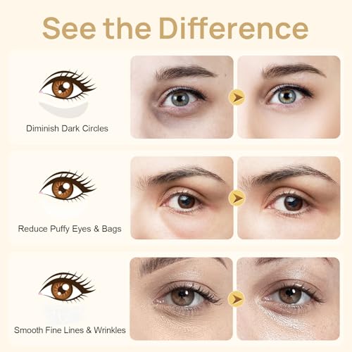 Under Eye Patches - 24K Gold Eye Mask for Puffy Eyes and Dark Circles, Wrinkles, Fine Lines, Collagen Skin Care Products, Gel Eye Patches for Dark Circles, Puffy Eyes, Undereye Bags