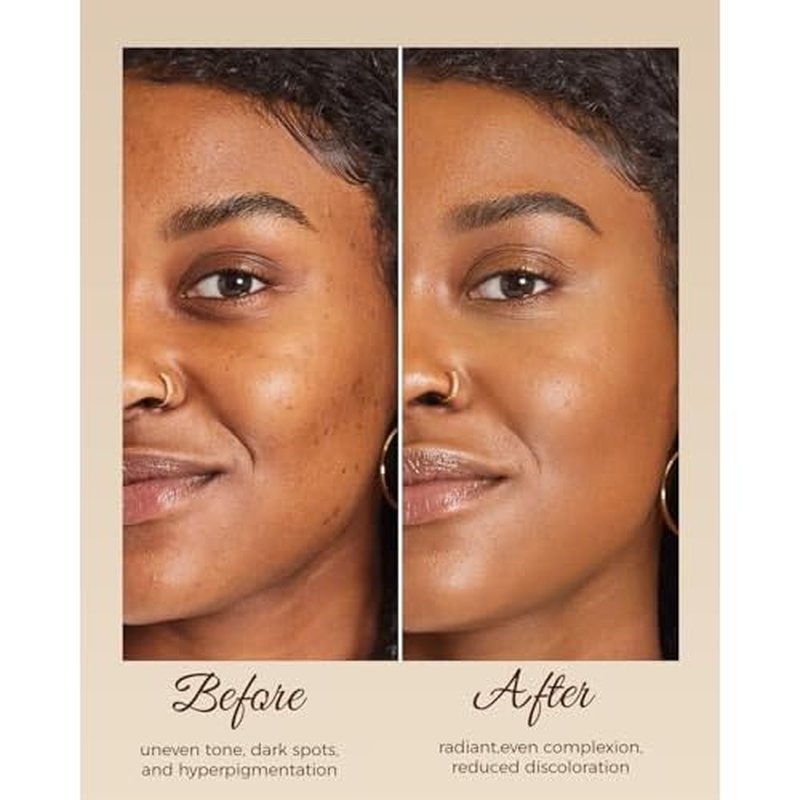 Kojic Acid Soap, Turmeric Soap for Dark Spots with Vitamin C & Shea Butter, Paraben & Sulfate-Free - 3 Bars with African Net Sponge