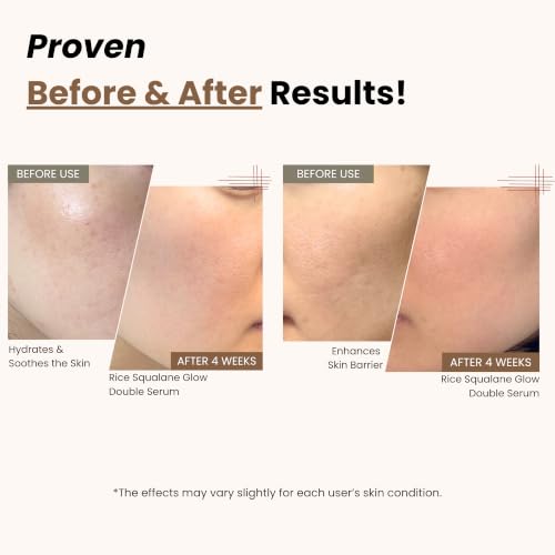 Hydrating Rice Squalane Serum with Niacinamide & Hyaluronic Acid - Vegan Korean Skincare, 50ml