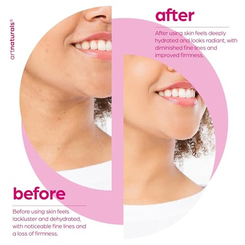 artnaturals Collagen Booster Serum for Face - Anti-Aging Reduces Wrinkles and Boosts Collagen - Heals and Repairs Skin - Improves Tone and Texture - Hyaluronic Acid & Vitamin E - 1 oz.