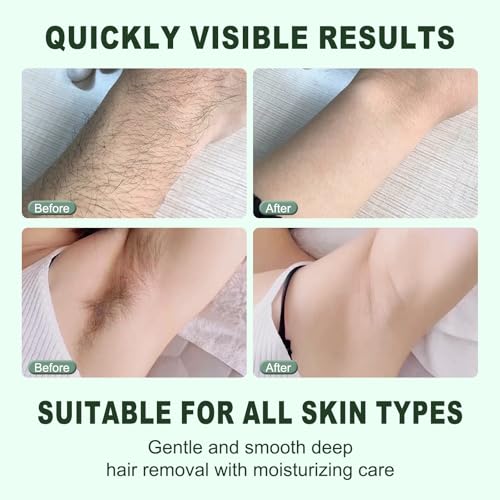 AgeVance Cyperus Rotundus Hair Removal Cream Pack of 3 - Gentle & Effective for Arms, Legs & Underarms, 3.52 Oz Each
