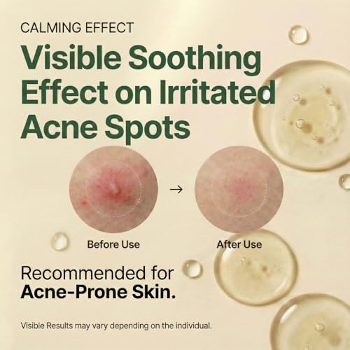 1PCS Centella Serum with 494,700 ppm Centella Asiatica for Sensitive Skin - Unscented, Soothing Ampoule, 30ml