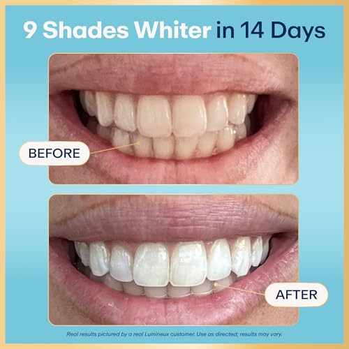 Lumineux Whitening Starter Set with 7 Treatment Strips & 2-Pack Toothpaste - 1 Month Supply