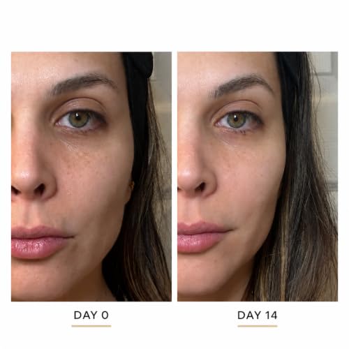 Vitamin C Serum with Sodium Ascorbyl Phosphate – Natanna STEM C-20 Brightening & Hydrating