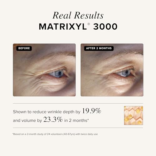 Asterwood Matrixyl 3000 + Argireline Serum for Face - Multi Peptide Serum with Hyaluronic Acid - Anti-Aging, Wrinkle Reducing, Collagen Boosting - Fragrance-Free - 8 Fl Oz
