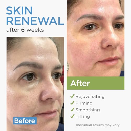 Collagen Cream for Face with Stem Cells Retinol Hyaluronic Acid Niacinamide (1.7 Oz) / Retinol Serum for Face (1Oz)