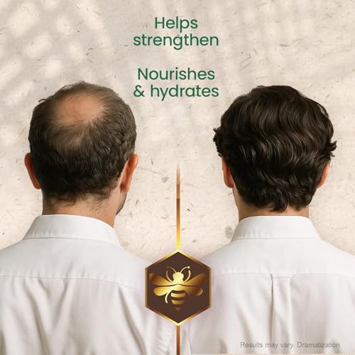 Tio Nacho Mexican Herbs Shampoo, Strengthening Hair Care with Royal Jelly, Ginseng, Wheat and Jojoba Oil, Honey Scented-14 Fl Oz
