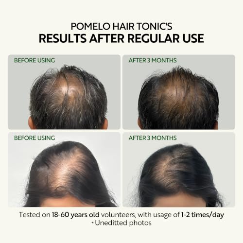 Vietnam Pomelo Hair Tonic 140ml Hair Serum for Thinning Hair - Hydrating & Strengthening - Variation of Hair Tonic 4.73 Fl oz