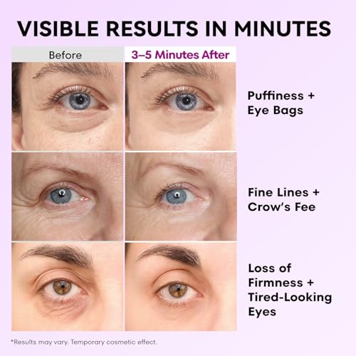 Instant Firm Eye Tightener: Upgraded Formula for Women Helps Reduce Eye Bags Puffiness and Wrinkles in 3-5 Minutes When Time Matters 1.34 oz