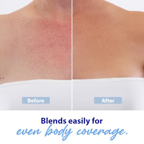 Dr. Denese Glow Younger Body Concealer Natural 3.4oz Full Coverage for Veins & Discoloration
