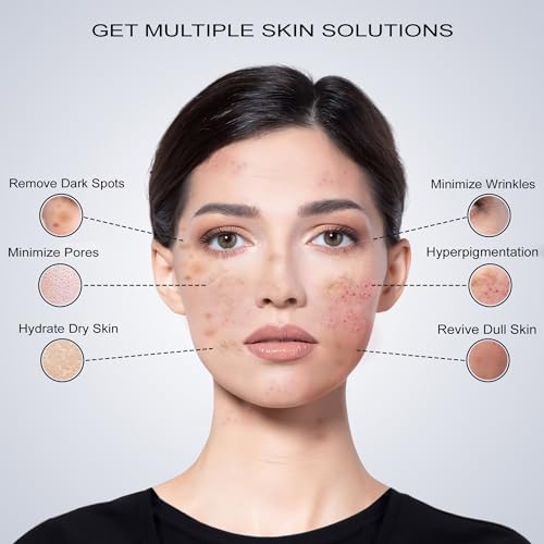 Hydrating Repair & Glow Face Serum with 10% Niacinamide + 5% Vitamin C (MAP), 1.5% HA & Glutathione ? Brightening & Dark Spot Corrector ? targets hyperpigmentation ? Antioxidant-Rich ? 30ml