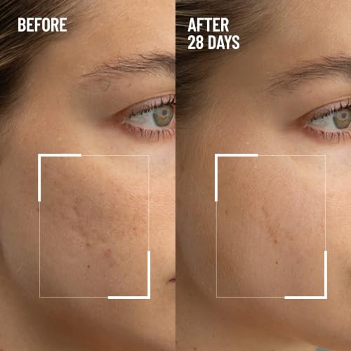 Dr. Brandt Microdermabrasion Gentle Face Exfoliator 2.1 oz - Pack of 1