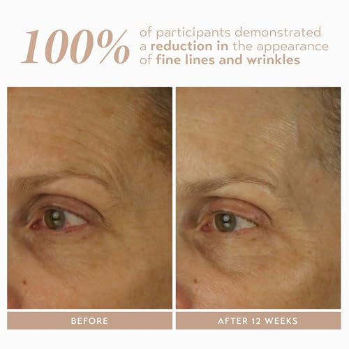 Travel Size Retinol Serum with Encapsulated 1% Retinol - Sensitive Skin Care