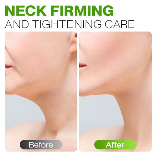 Advanced Neck Firming Cream Anti Aging Skin Firming Neck cream for tightening & lifting Wrinkles, Sagging or Crepe Skin Under Chin, Face and Chest with Peptides, Vitamin C & Hyaluronic Acid