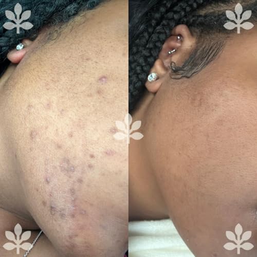 Goat Face & Body Bar for Hyperpigmentation - Nourishing & Brightening