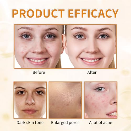 7% Glycolic Acid Exfoliating Toner, Exfoliating Facial Toner, Pore Minimizing Toner, Smooth Skin, Even Tone, Hydrating Formula