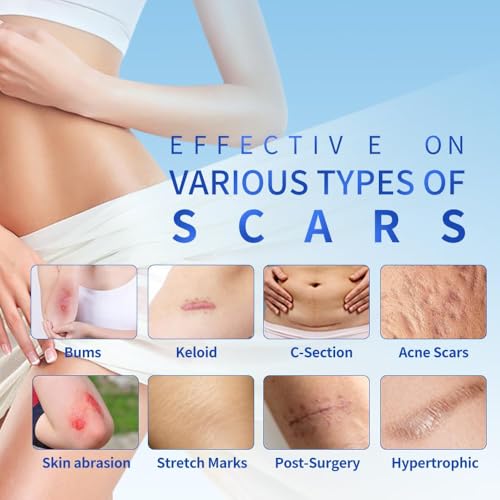 Silicone Scar Sheets 1.6"x59" Roll-1.5M Scars Removal Treatment Medical Grade Silicone Scar Tape for Skin Resuable Strip for Tummy Tuck,Incision,Keloid,C-Section,Burn,Acne Scars