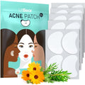 LitBear Acne Patches Large, Hydrocolloid Pimple Patches for Breakouts, Zit and Blemish, Large Acne Patches for Face, Chin, Back and Body with Tea Tree & Calendula Oil