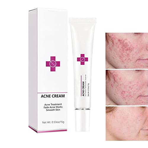 Calming Relief Cream - 8.5 oz / 250 ml - Moisturizing Comfort from Itchy Skin, Helps Alleviate Itch from Eczema, Hives, Sunburn - Vegan Formula with Shea Butter & Tea Tree Oil - by NextGenU