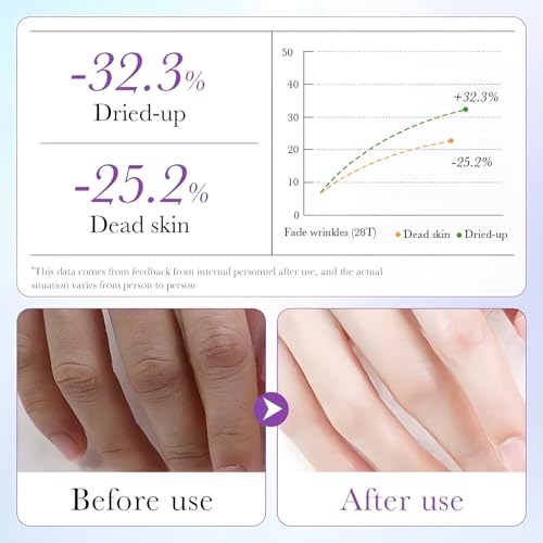 Moisturizing Hand Masks Set - Hydrating Collagen Gloves for Dry Skin, Lavender Scent
