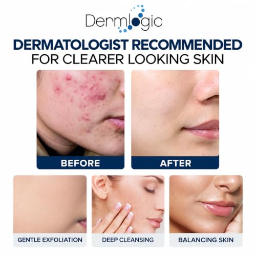 Acne Treatment Pads with Glycolic Lactic Salicylic Acid for Face & Body