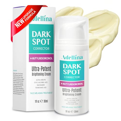 Dark Spot Remover for Face: Dark Spot Corrector for Sun Spots, Age Spots & Uneven Skin Tone - Vitamin C, Alpha Arbutin & Niacinamide for Even Skin Tone (1 Fl Oz)